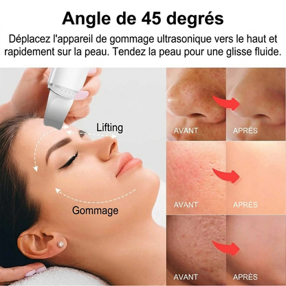 Kelya Ultrasound - Skin Exfoliator