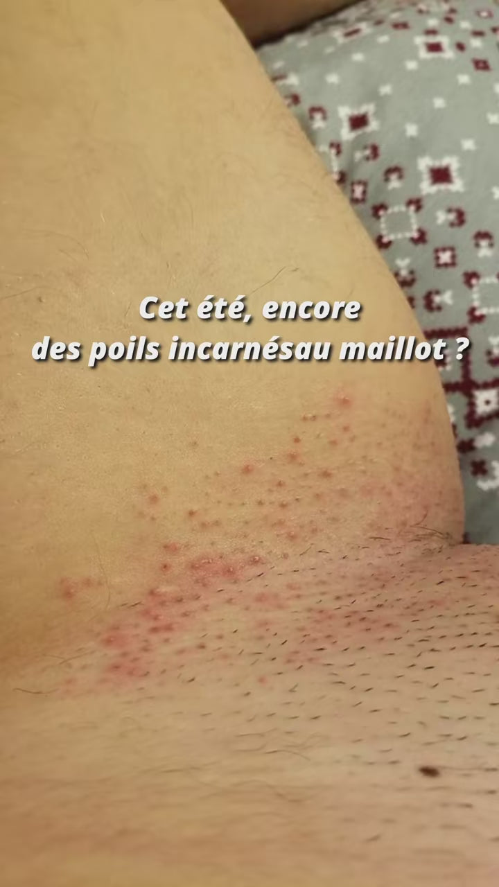 Têtes de Rechange Officielles