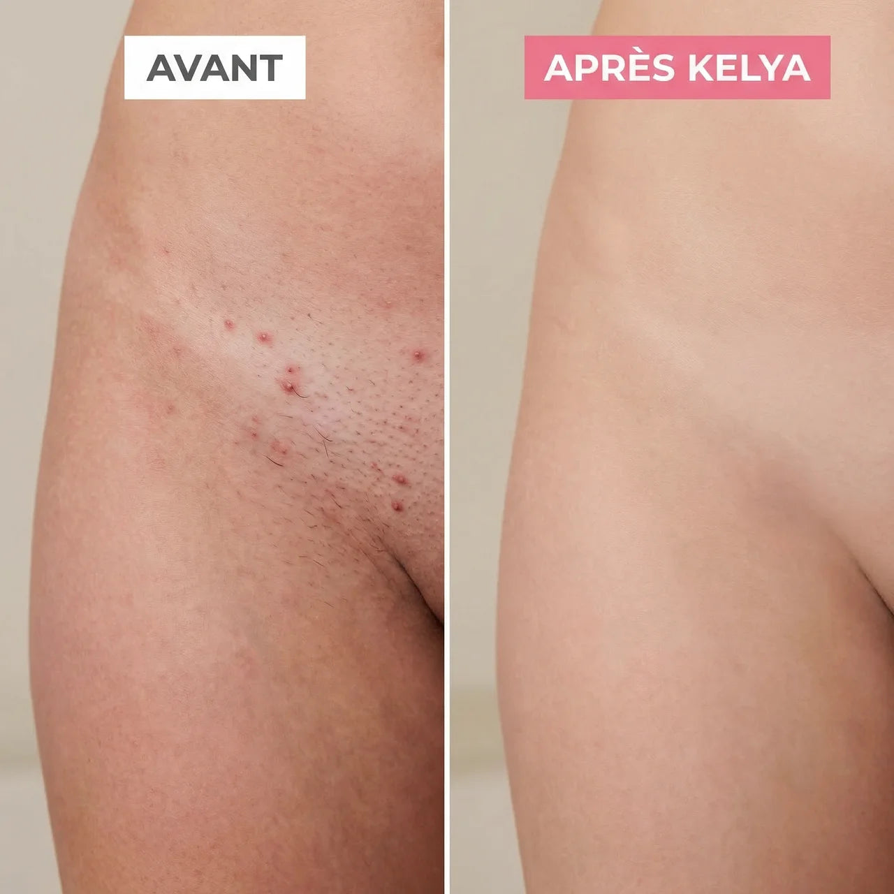 Kelya® Rasoir 2-en-1