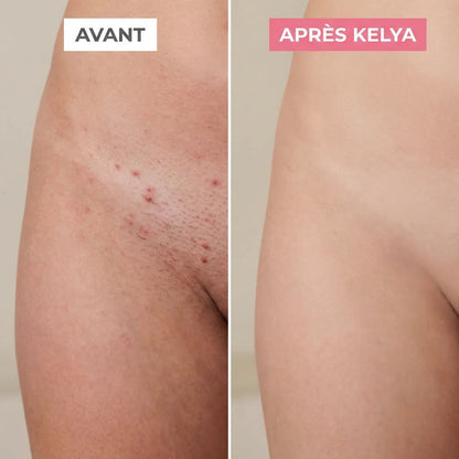 Kelya® Rasoir 2-en-1